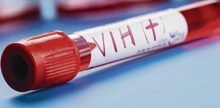 BALANCE POSITIVO ANTE EL SEGUNDO CASO DE REMISIÓN DEL VIH EN EL MUNDO